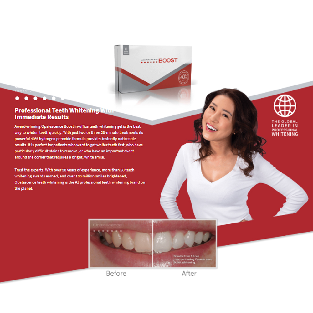 Opalescence Boost 40% PF Ameri - Teeth Whitening Gel Opalescence recension och pris