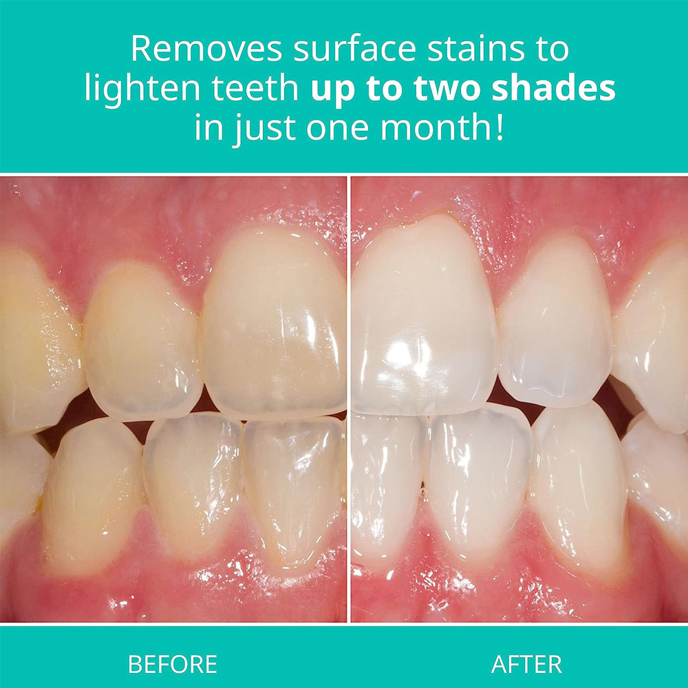 Opalescence Whitening Toothpas - Teeth Whitening Gel Opalescence recension och pris