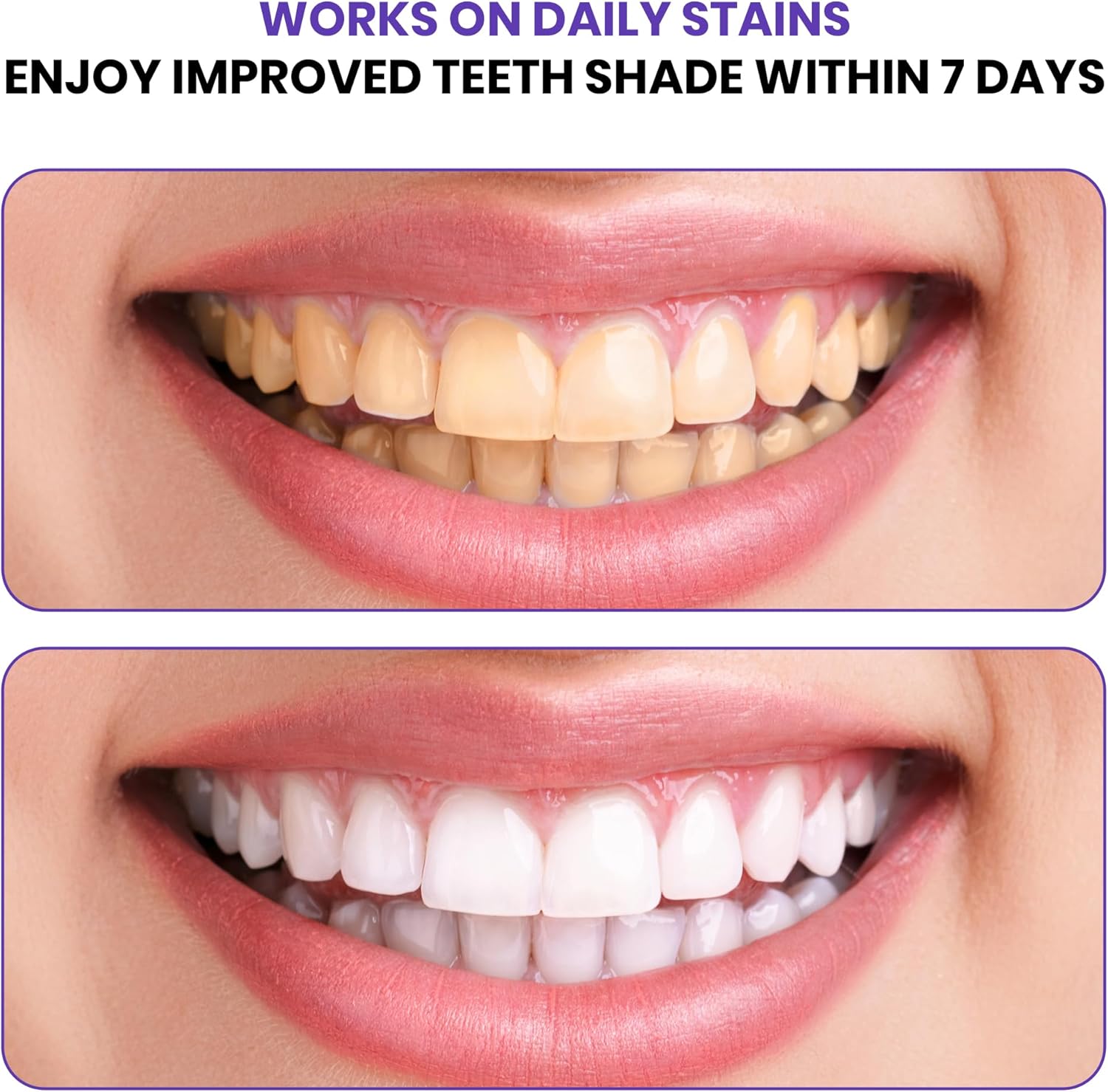Advanced Purple Teeth Whitenin - Teeth Whitening In Office recension och pris