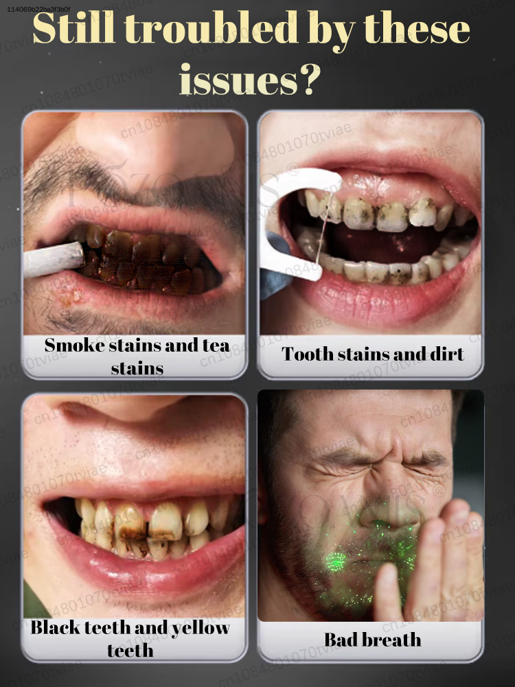 POZOAMIS 30% Hydroxyapatite To - Teeth Whitening In Office recension och pris