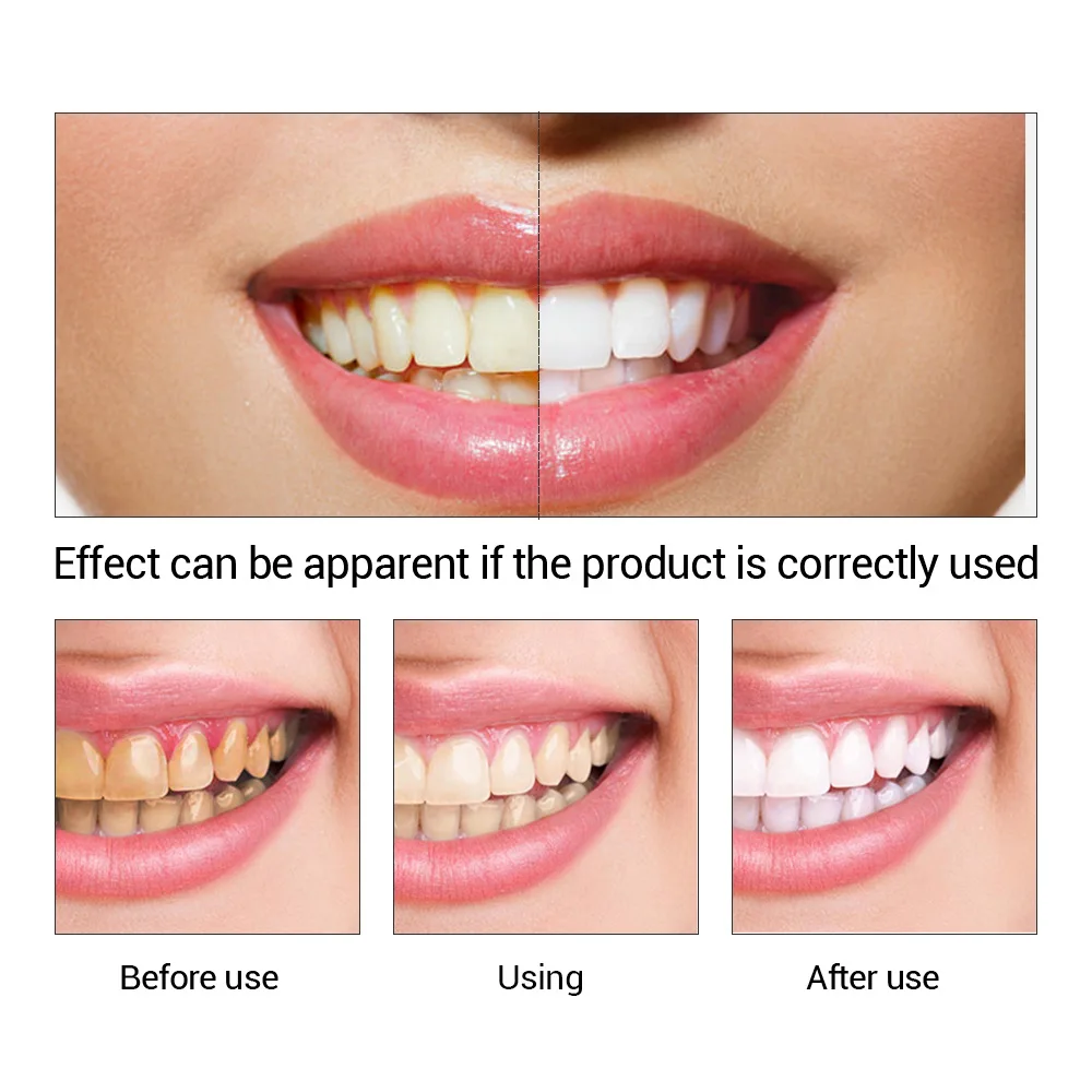 FTEENPLY Teeth Whitening Essen - Teeth Whitening Paste recension och pris