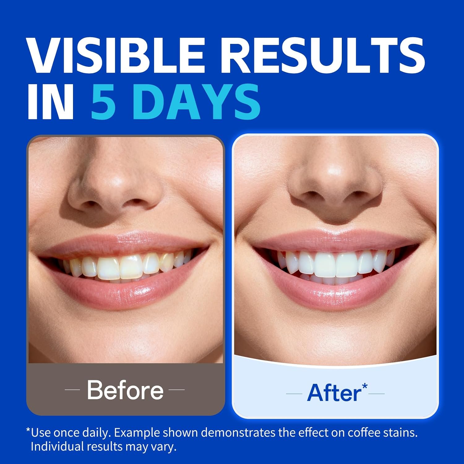 7 pairs Teeth Whitening Strips - Teeth Whitening Strips Crest recension och pris