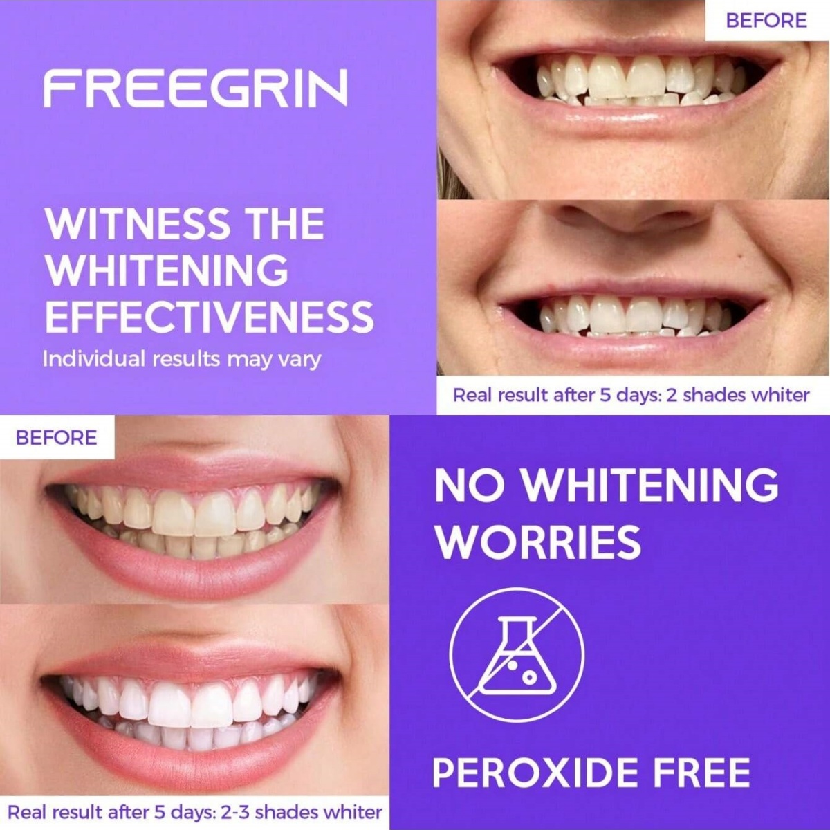 Deluxe Whitening Teeth Sticker - Teeth Whitening In Office recension och pris