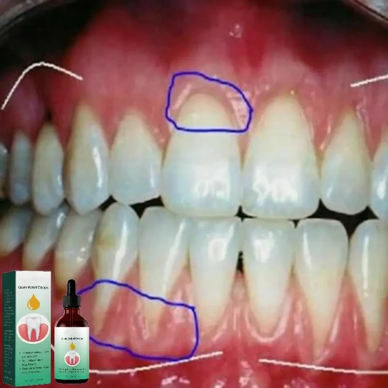Gum Repair Drops Relieve Reced - Teeth Whitening Paste recension och pris