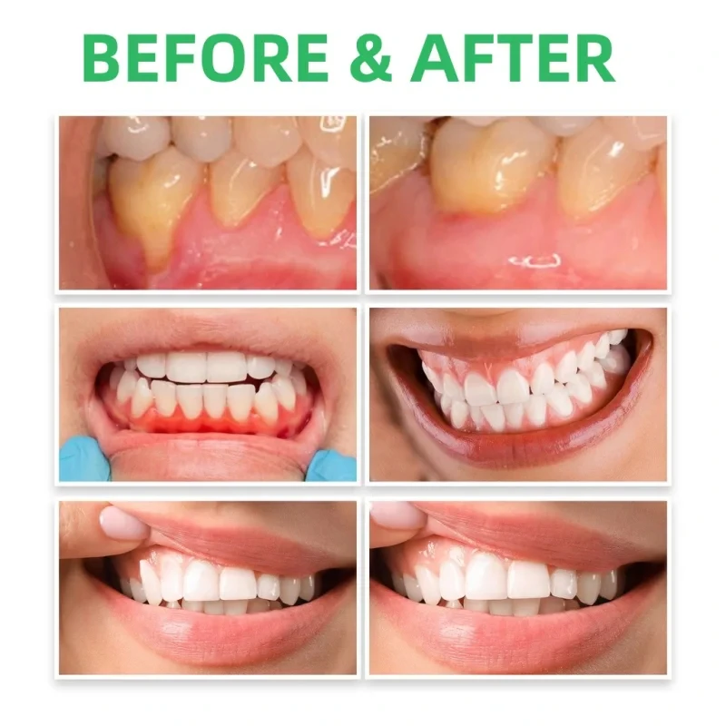 Gum Repair Drops Relieve Reced - Teeth Whitening Paste recension och pris