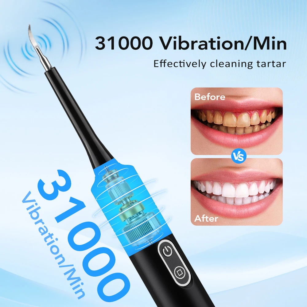 Electric Sonic Vibration Denta - Teeth Whitening Professional recension och pris