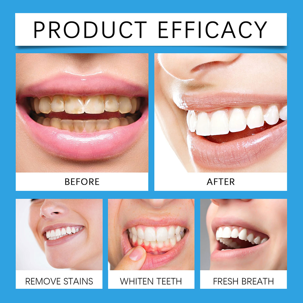 Professional Teeth Stain Remov - Teeth Whitening For Photos recension och pris
